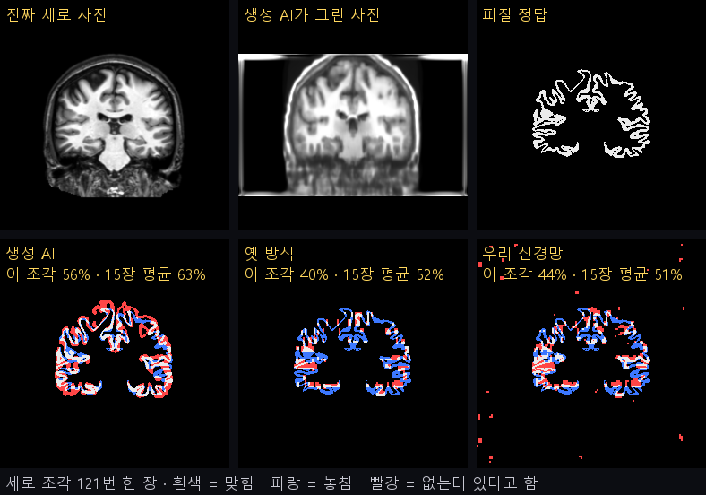 세로 사진 한 장에서 진짜, 생성 AI가 그린 사진, 세 방법의 주름 띠 비교