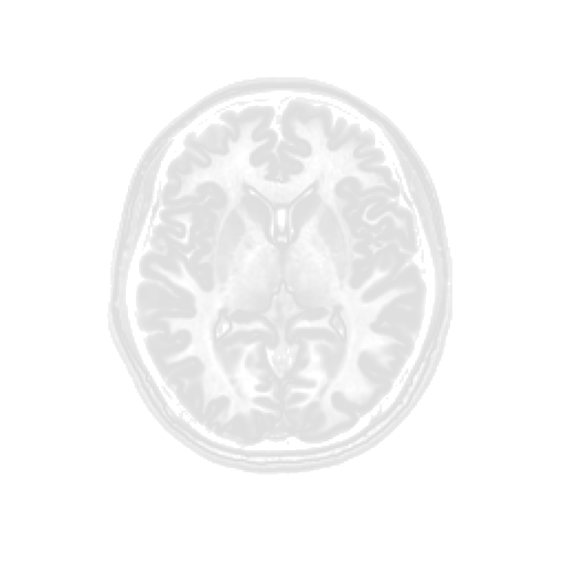 머리를 가로로 자른 흑백 MRI 사진